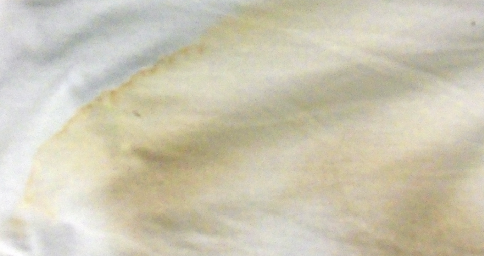 How To Remove Sweat Stains From Pillow Cases